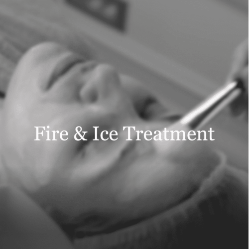 “Vatra i led” iS Clinical tretman